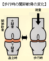 関節軟骨の役割